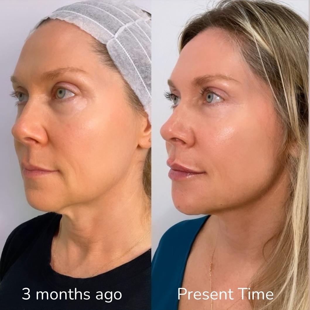 Instagram post from NuGen Wellness & Aesthetics